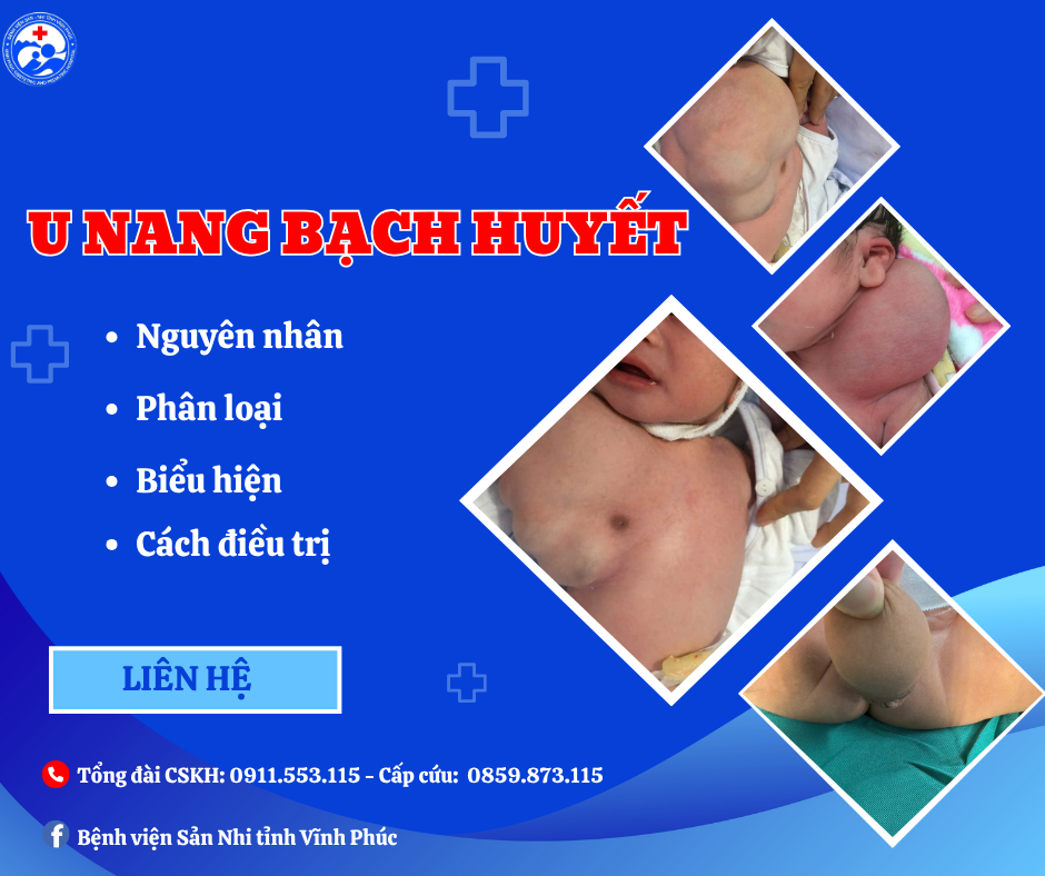 U nang bạch huyết ở trẻ em: Nguyên nhân, biểu hiện, điều trị