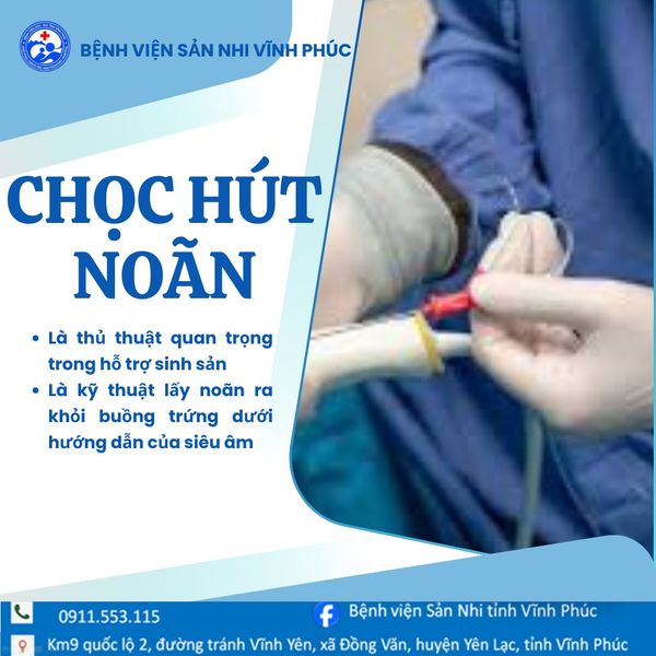CHỌC HÚT TRỨNG VÀ NHỮNG ĐIỀU CẦN LƯU Ý.