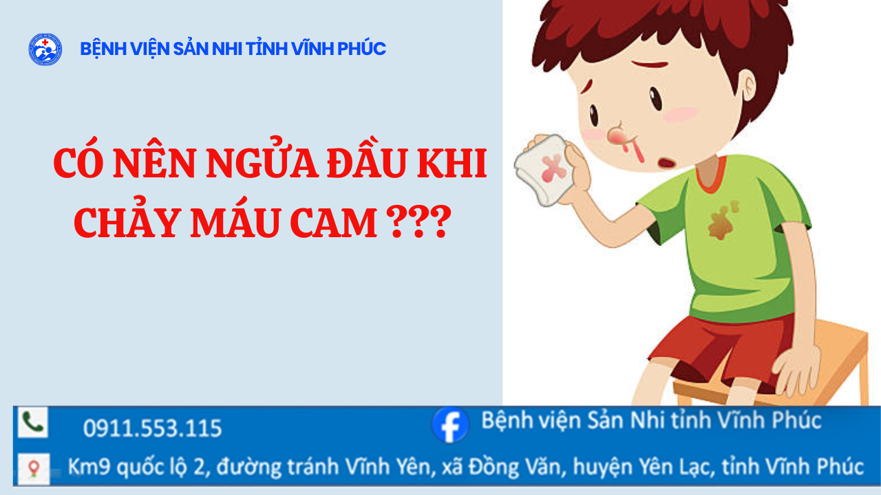 CÓ NÊN NGỬA ĐẦU ĐỂ CẦM CHẢY MÁU CAM