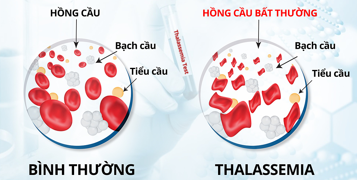 Anh dai dien