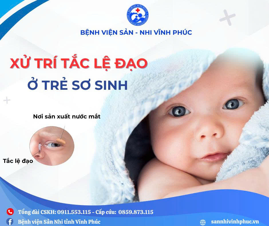 Tắc lệ đạo - Tắc tuyến lệ: Những điều cần biết.