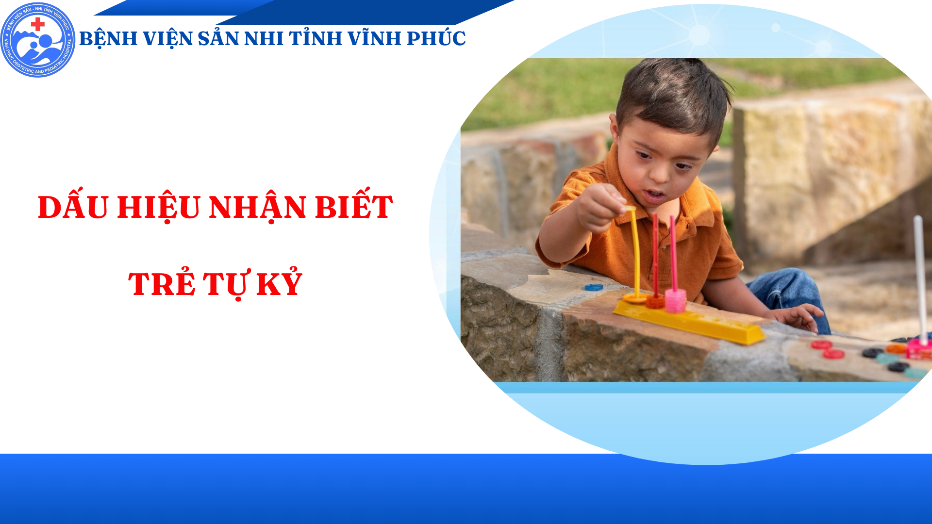 DẤU HIỆU NHẬN BIẾT TRẺ TỰ KỶ