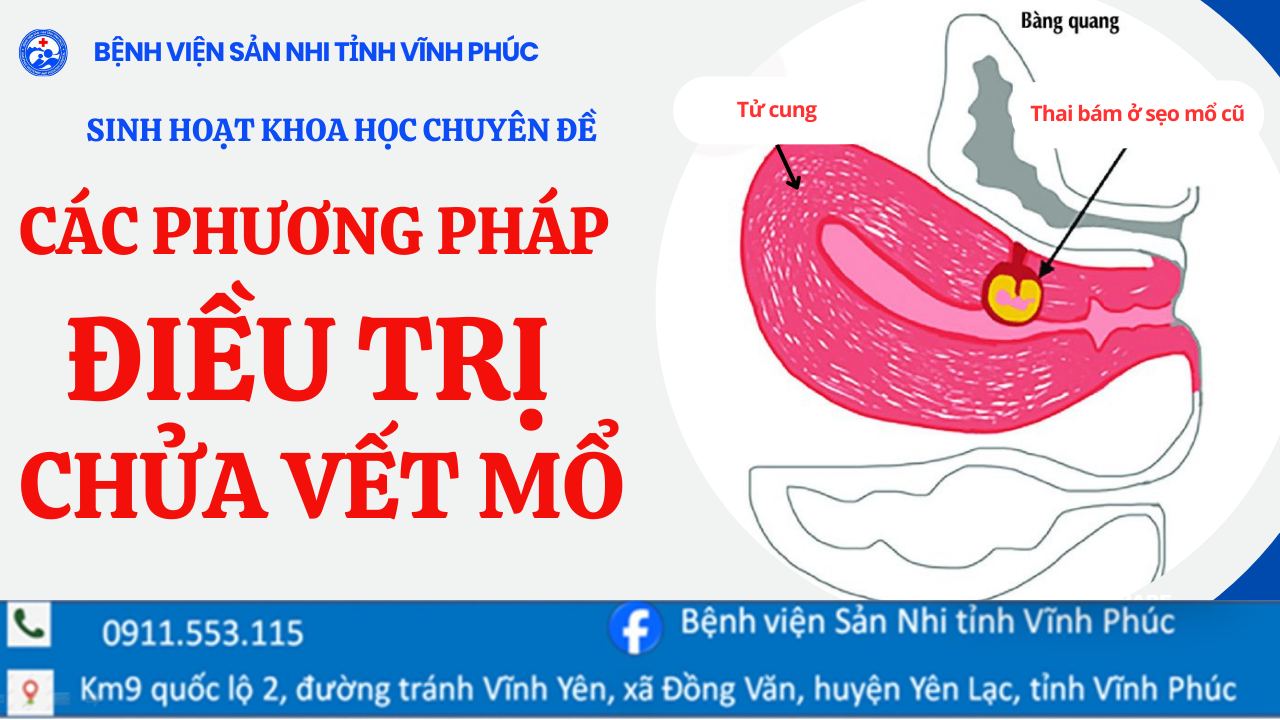 SINH HOẠT KHOA HỌC CHUYÊN ĐỀ: CẬP NHẬT PHƯƠNG PHÁP ĐIỀU TRỊ CHỬA VẾT MỔ TẠI BỆNH VIỆN SẢN NHI TỈNH VĨNH PHÚC