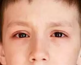 126