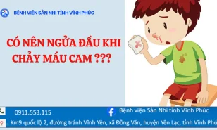 CÓ NÊN NGỬA ĐẦU ĐỂ CẦM CHẢY MÁU CAM