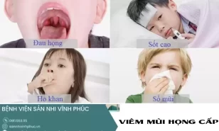 Chăm sóc trẻ bị viêm mũi họng cấp