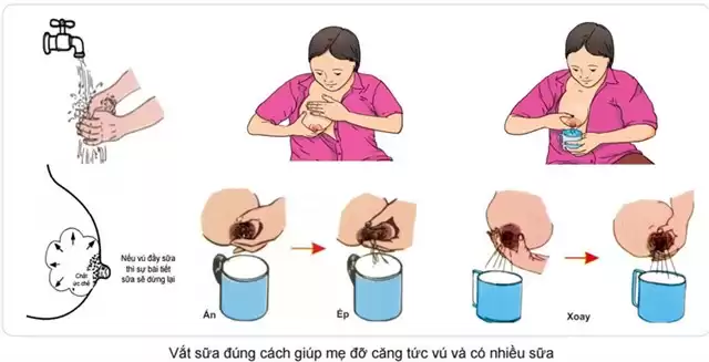 Hướng dẫn các bước vắt sữa mẹ bằng tay
