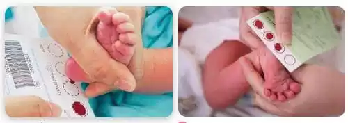 Lấy mẫu máu gót chân