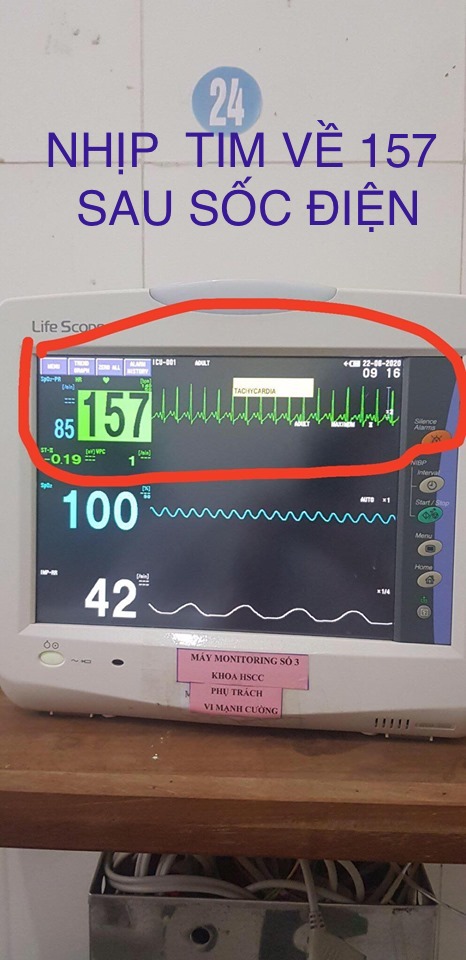 KHÔNG CHỦ QUAN VỚI BỆNH TRẺ NHỎ