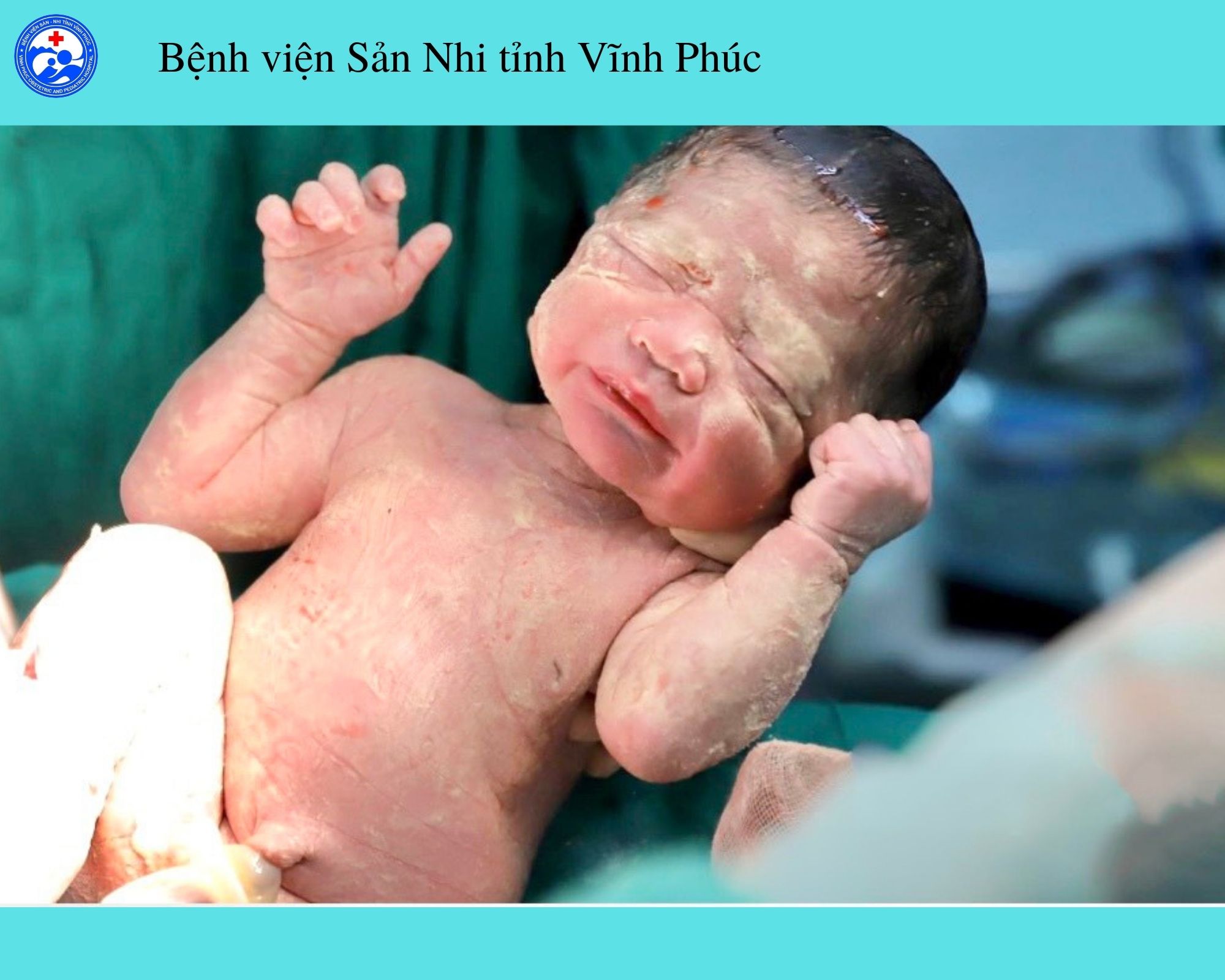 LỚP SÁP TRÊN DA TRẺ MỚI SINH CÓ PHẢI CHỈ LÀ GHÉT BẨN?