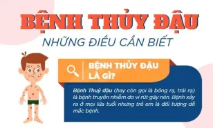 Những điều cần biết về bệnh thủy đậu