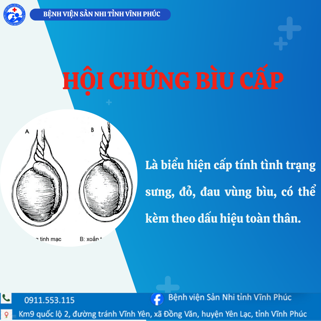 HỘI CHỨNG BÌU CẤP