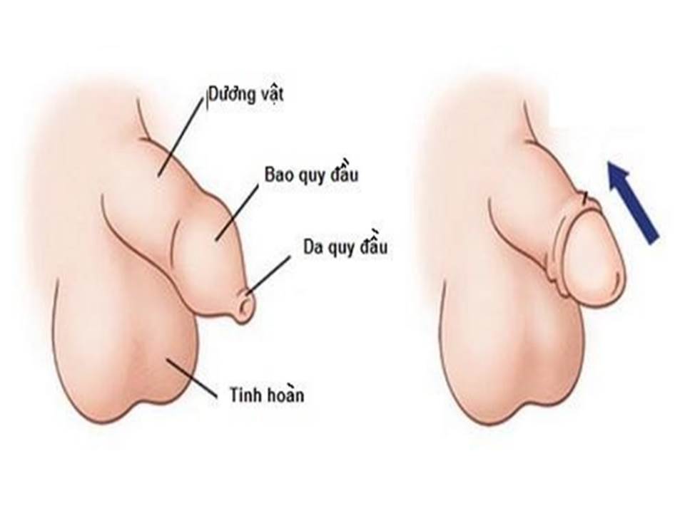 TIÊM VẮC XIN TIỀN HÔN NHÂN VÀ TRƯỚC KHI MANG THAI VÔ CÙNG CẦN THIẾT