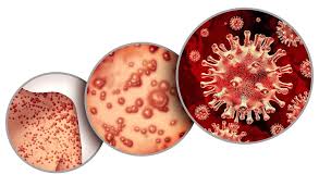 KHUYẾN CÁO PHÒNG CHỐNG BỆNH ĐẬU MÙA KHỈ