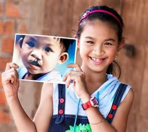 Chương trình Phẫu thuật sứt môi hở vòm đợt 6 vì nụ cuời trẻ thơ – Hướng đến ngày quốc tế thiếu nhi 1/6