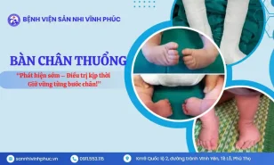 Bàn chân thuổng – Phát hiện sớm, điều trị kịp thời.