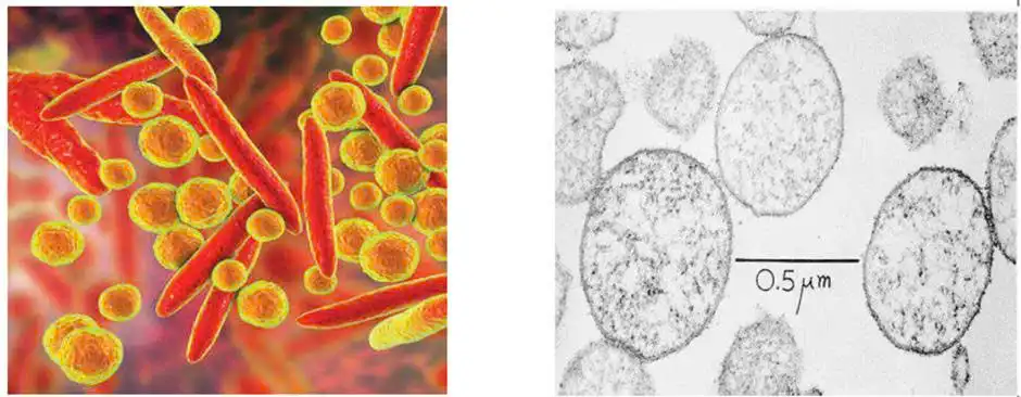 Viêm phổi do vi khuẩn Mycoplasma ở trẻ em. 1 Hình ảnh vi điện tử của các tề bào Mycoplasma mặt cắt mỏng. {2}