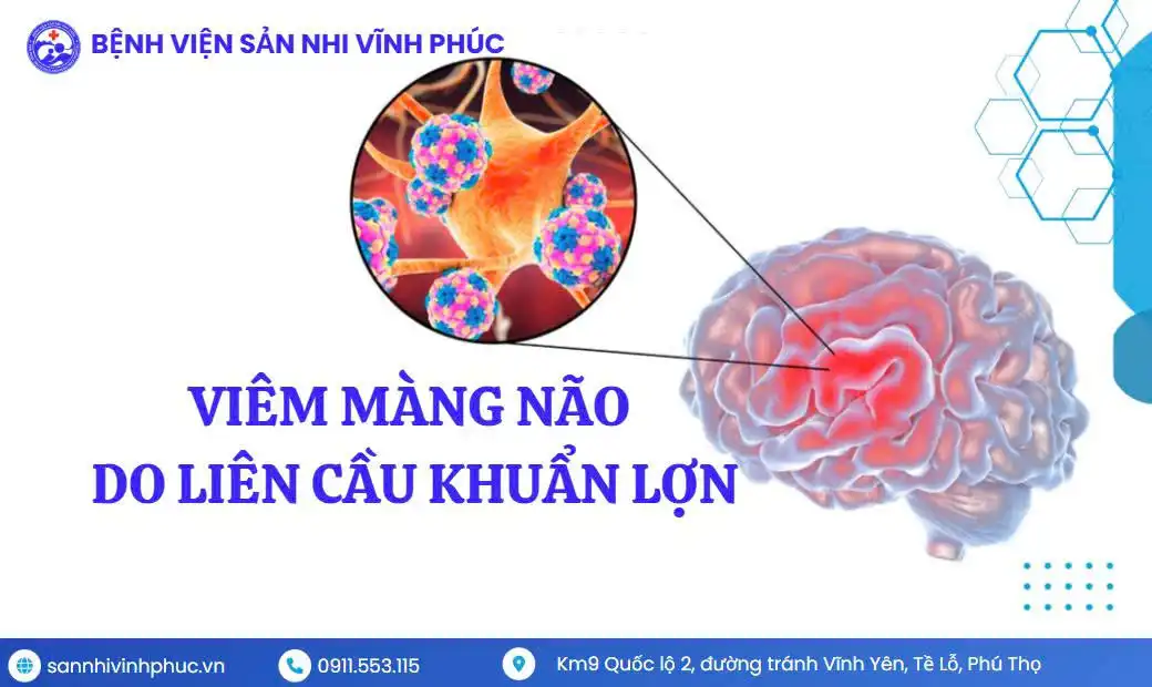 Viêm màng não do liên cầu khuẩn lợn (Streptococcus suis) 1 Viêm màng não do liên cầu khuẩn lợn