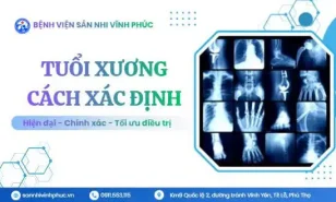 Bạn có biết tuổi xương là gì ? Cách xác định tuổi xương cho trẻ?