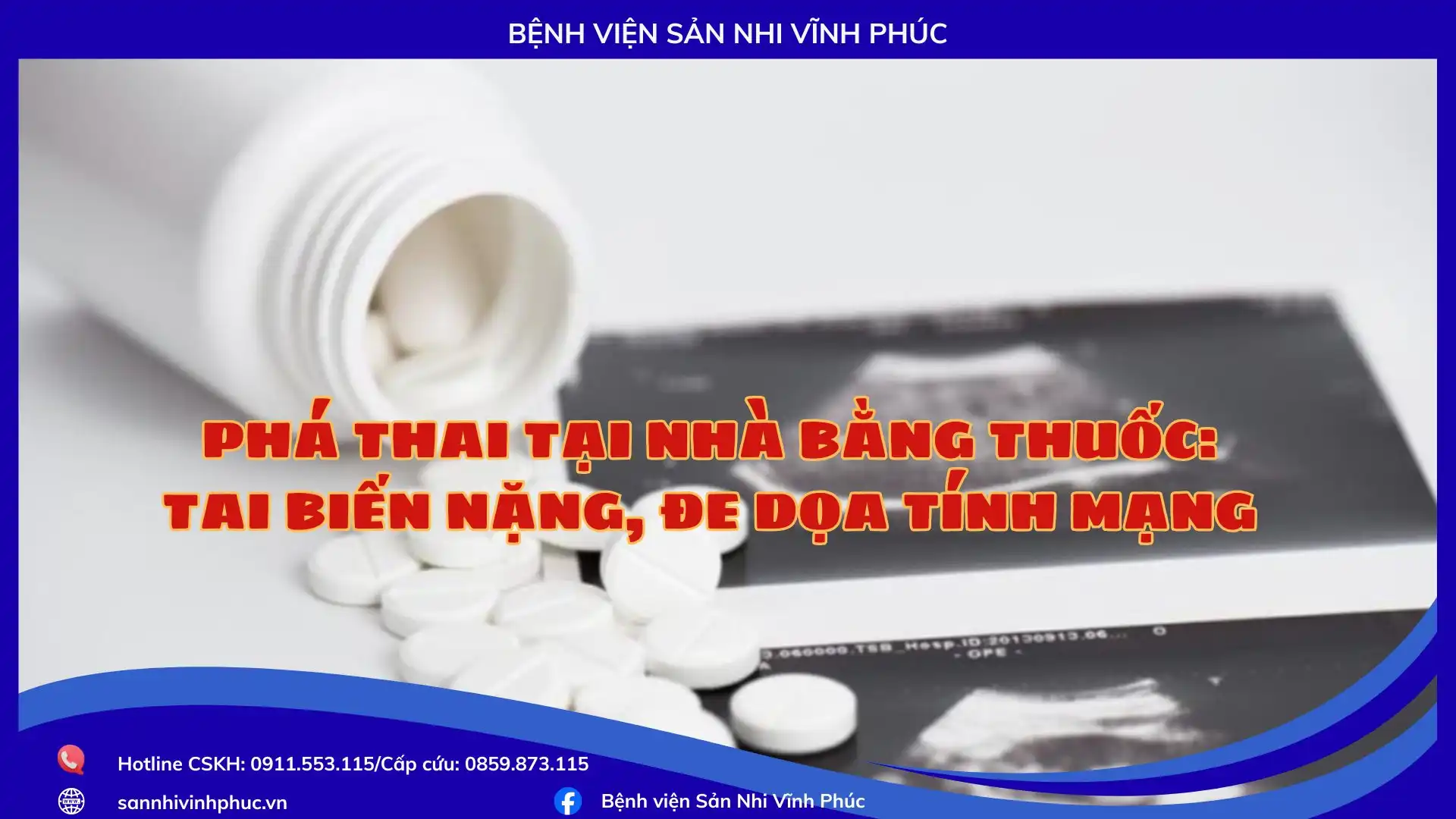 Phá thai tại nhà bằng thuốc: nguy cơ tai biến nặng, đe dọa tính mạng 1 Phá thai tại nhà bằng thuốc: nguy cơ tai biến nặng, đe dọa tính mạng