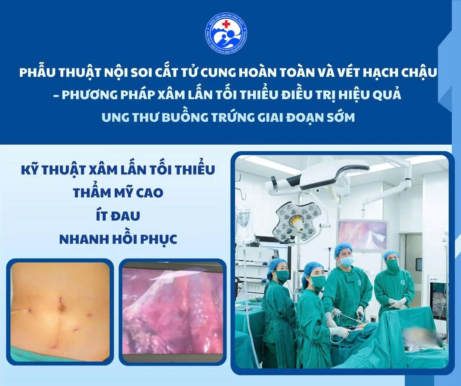 Phẫu thuật nội soi triệt căn ung thư buồng trứng giai đoạn sớm tại Bệnh viện Sản Nhi Vĩnh Phúc năm 2026 1 Phẫu thuật nội soi cắt tử cung hoàn toàn và vét hạch chậu – phương pháp xâm lấn tối thiểu điều trị hiệu quả ung thư buồng trứng giai đoạn sớm