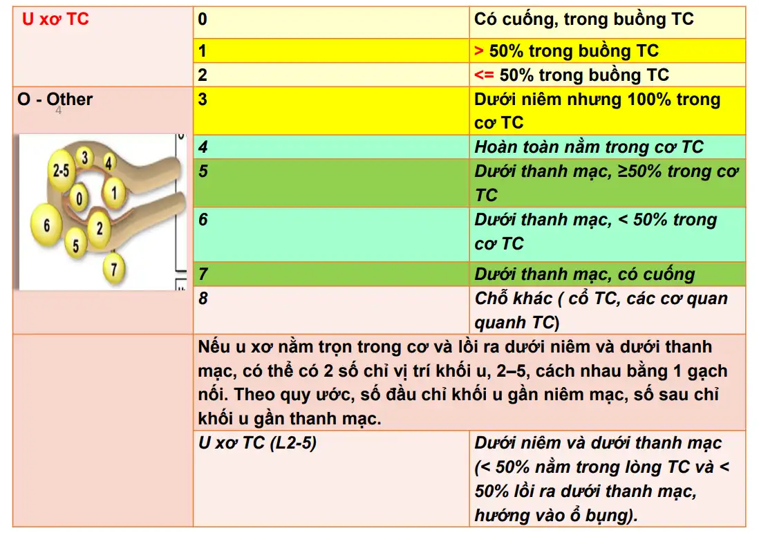 U xơ cơ tử cung: Nguyên nhân, triệu chứng, phân loại và giải pháp hiệu quả 1 Phân loại u xơ tử cung