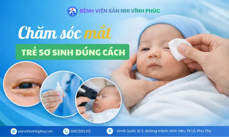 Chăm sóc mắt trẻ sơ sinh đúng cách