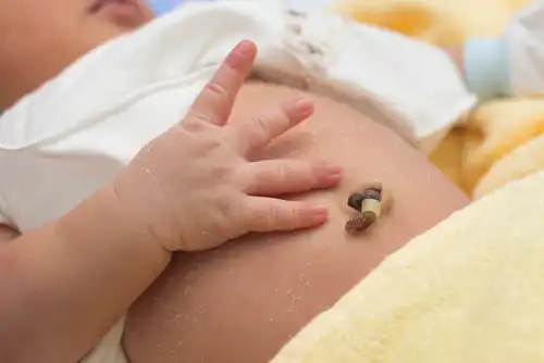 Chăm sóc rốn trẻ sơ sinh an toàn: Bao lâu rốn rụng và khi nào cần đi khám? 1 Chăm sóc rốn trẻ sơ sinh