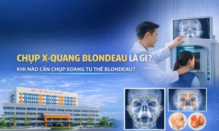 Chụp X-quang Blondeau là gì? Khi nào cần chụp xoang tư thế Blondeau?