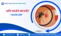 Sốt xuất huyết ở người lớn: Dễ chủ quan nhưng nguy cơ không hề thấp