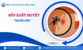 Sốt xuất huyết ở người lớn Dễ chủ quan nhưng nguy cơ không hề thấp