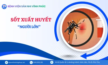 Sốt xuất huyết ở người lớn Dễ chủ quan nhưng nguy cơ không hề thấp