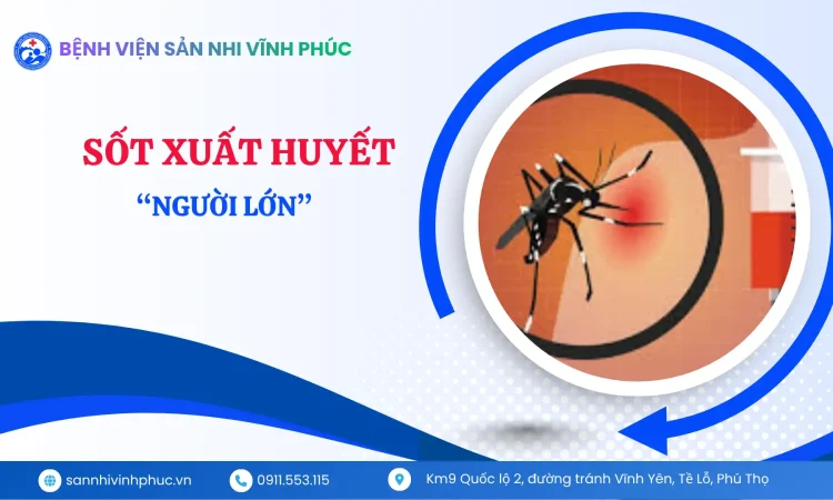 Sốt xuất huyết ở người lớn Dễ chủ quan nhưng nguy cơ không hề thấp