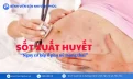 Sốt xuất huyết ở phụ nữ mang thai: Nguy cơ kép cho mẹ và thai nhi