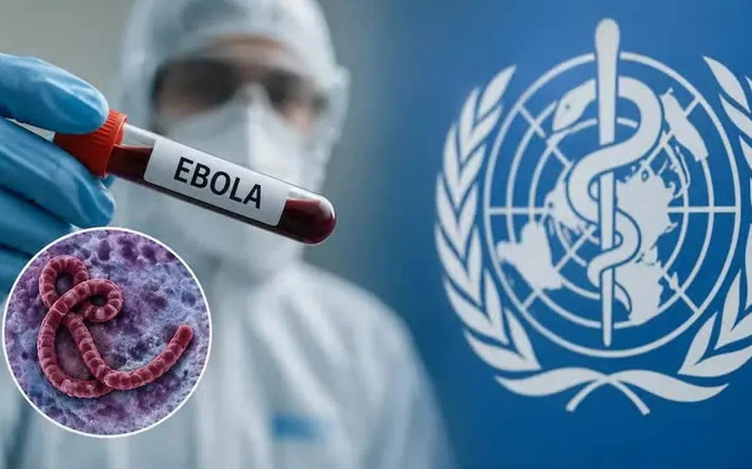 Khuyến cáo phòng, chống bệnh do virus Ebola - Bộ Y tế 2026 1 Virus Ebola
