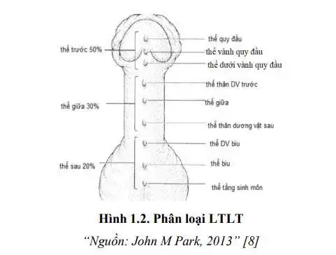 Lỗ tiểu lệch thấp ở trẻ em: Phát hiện sớm để điều trị hiệu quả 1 Phân loại lỗ tiểu lệch thấp