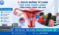 Polyp buồng tử cung – Vật cản thầm lặng khiến bạn chậm đón con yêu 25 Polyp buồng tử cung – Vật cản thầm lặng khiến bạn chậm đón con yêu